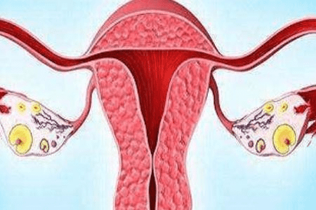 多囊卵巢患者的三种自我保健方法