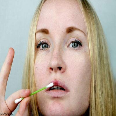 慢性唇炎可以用盐水洗吗 慢性唇炎的正确处理方法详述