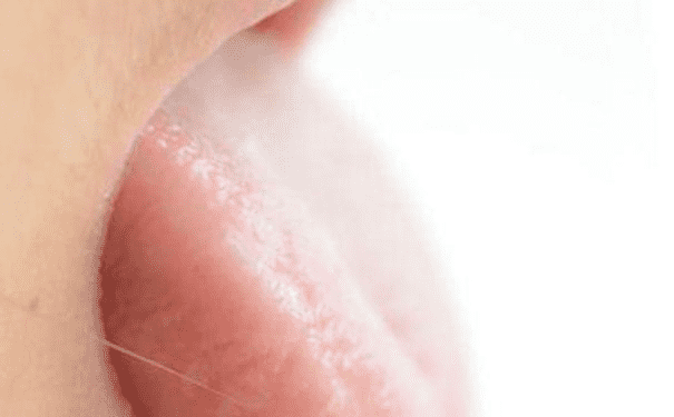 舌头肿胀是什么原因造成的？舌头肿胀是什么原因造成的？ 